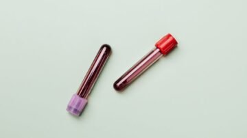 Dni wolne za oddanie krwi a wykonywanie pracy w nadgodzinach – jakie są zasady?